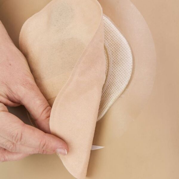 UltraFrame Flange Extenders on someone's skin and a hand pulling the stoma pouch showing the flange