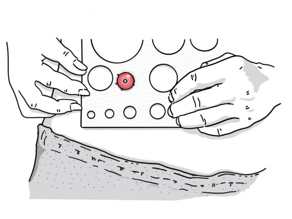 An illustration of someone using a measuring guide to measure their stoma