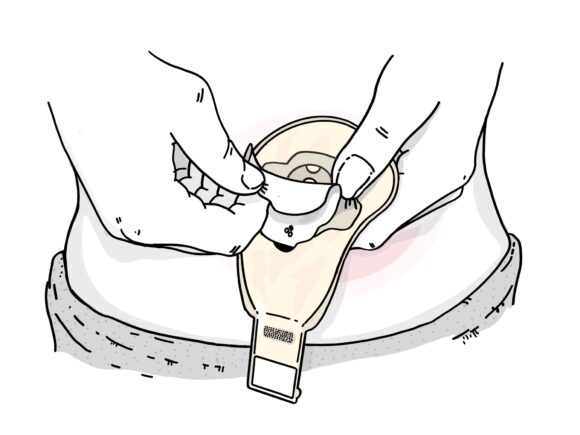 Illustration of a person peeling the backing paper off an adhesive flange