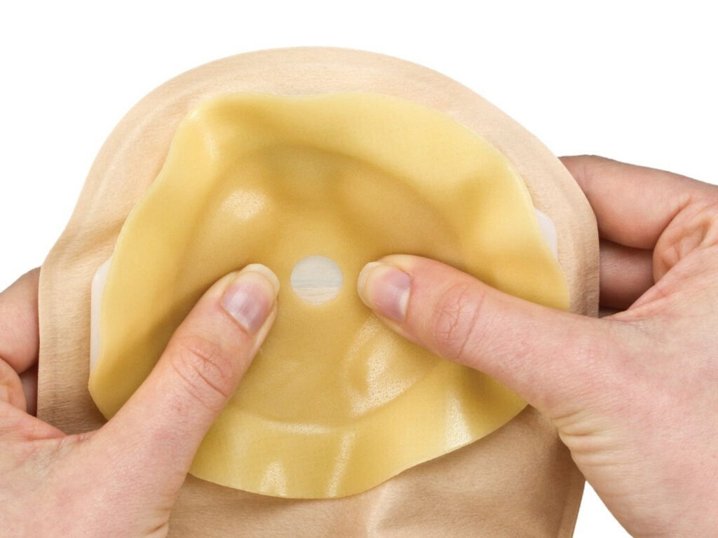 Photo of someone holding an Aura Profile stoma bag, pressing on the flange