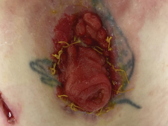 Skin improvement after five days