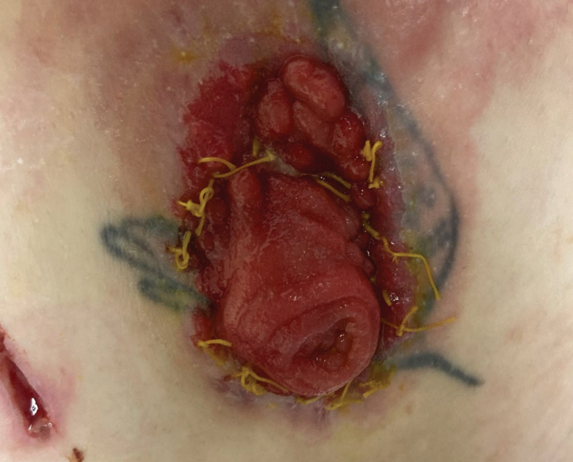 Skin improvement after five days