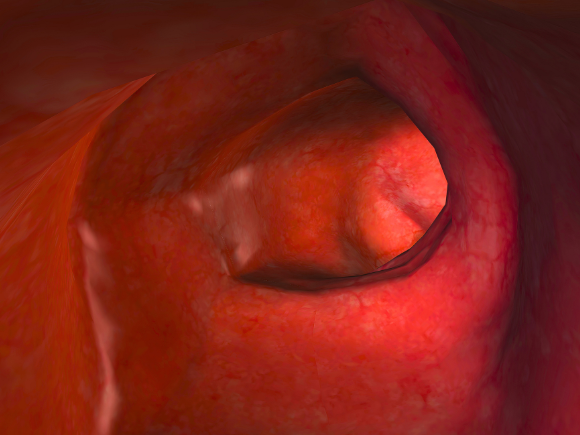 Illustration of a healthy large intestine