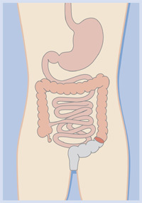 Adominoperineal excision of rectum diagram