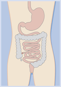 Total Colectomy Diagram